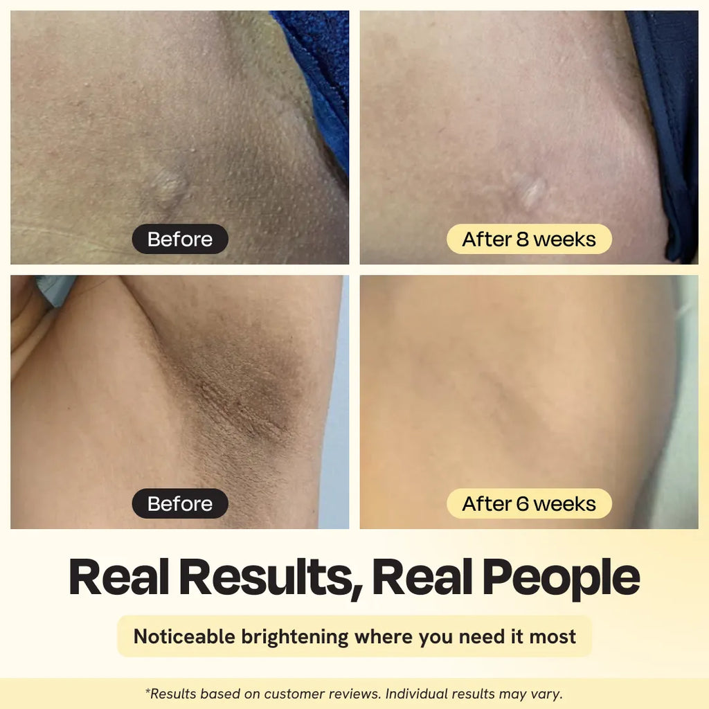 Brightening Intimate Serum for Dark Spots, Bikini Line & Inner Thighs