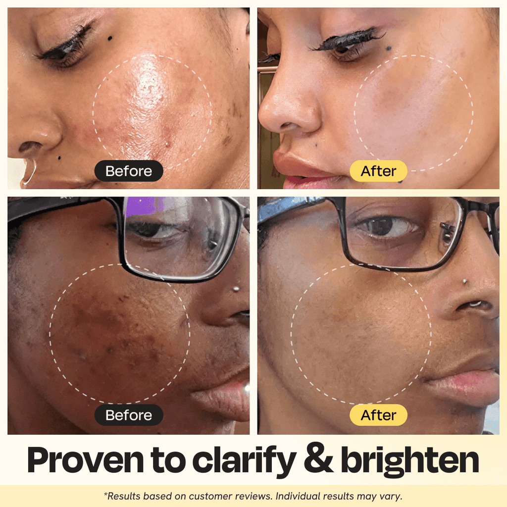 Vitamin C Clay Mask for Brightening, Dark Spots & Clear Skin