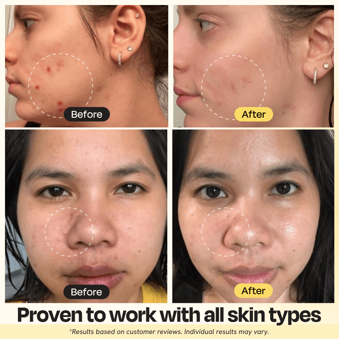 Vitamin C Clay Mask for Brightening, Dark Spots & Clear Skin