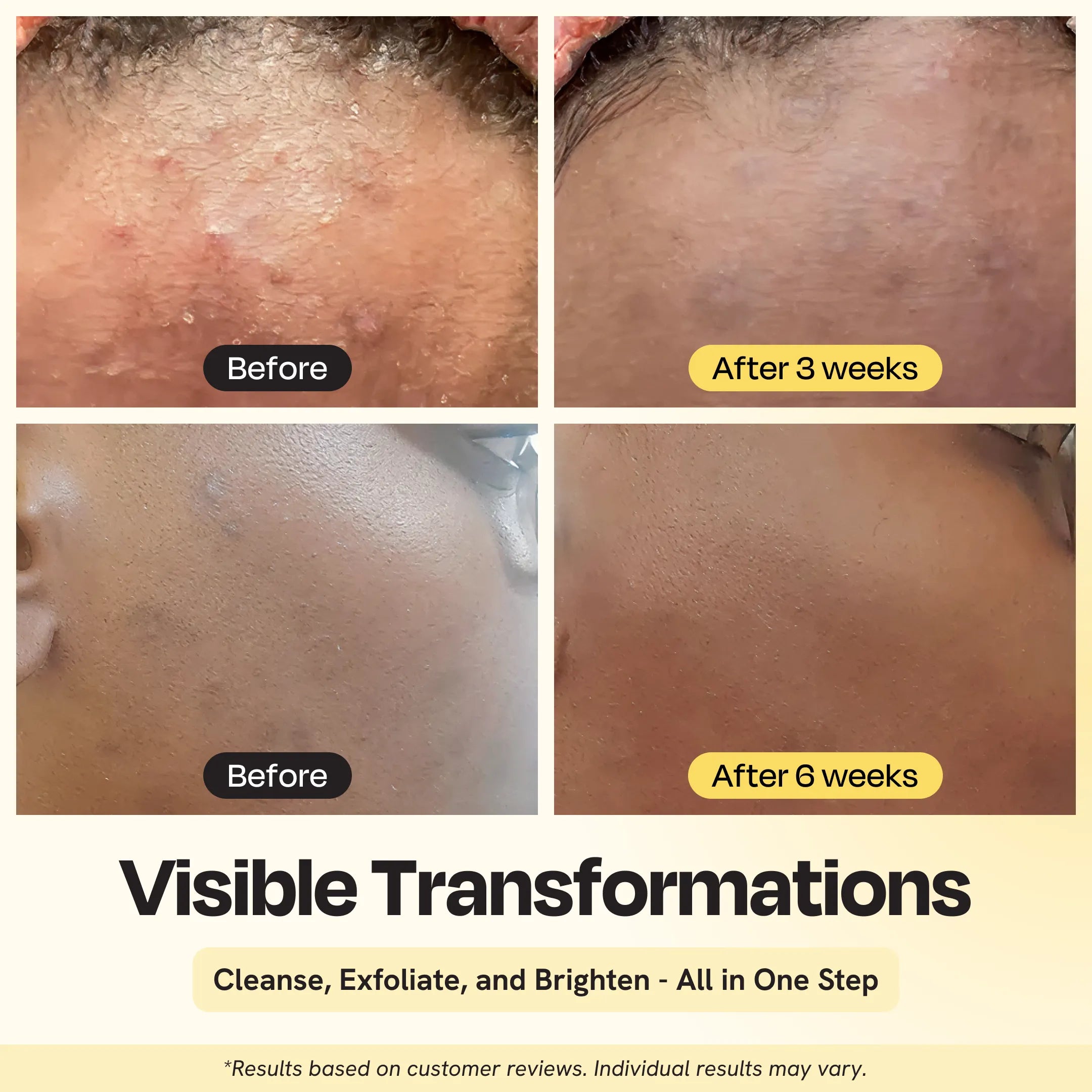 Brightening Facial Cleanser with Salicylic Acid, AHA & BHA for Clear Glowing Skin