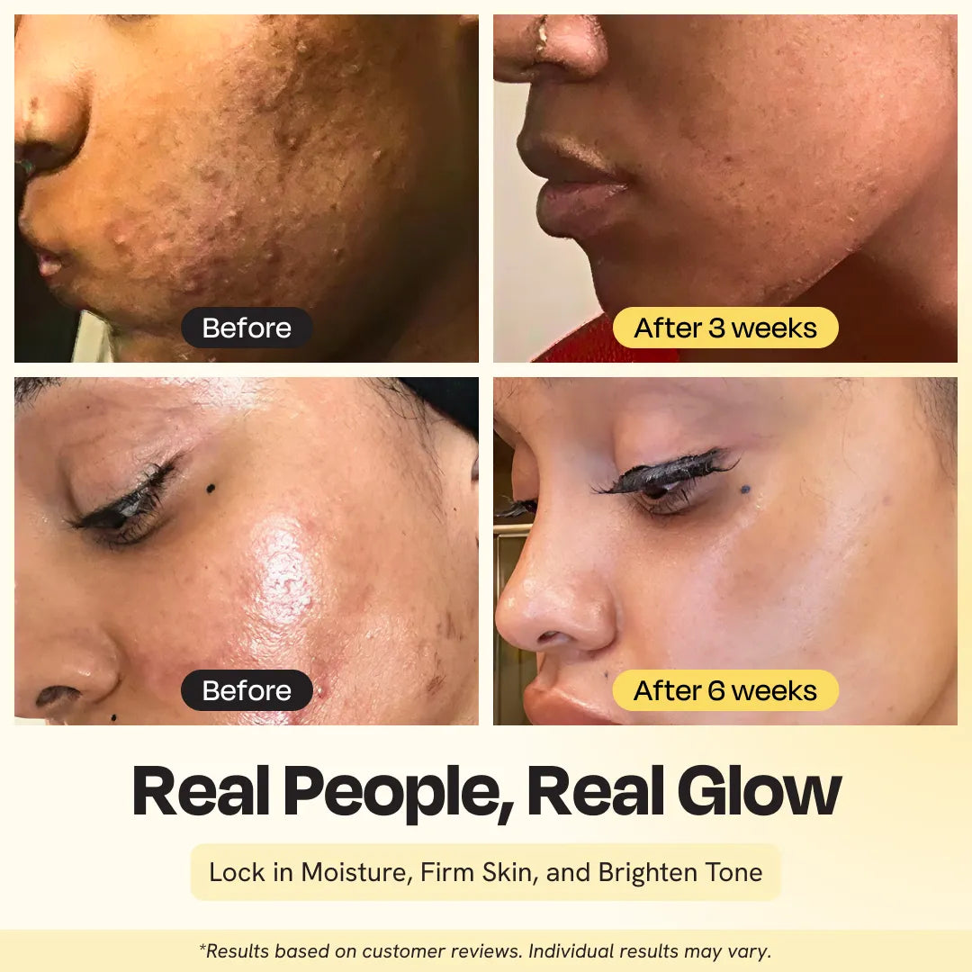 Supernutrient Face Oil for Hydration, Firming & Radiant Glow