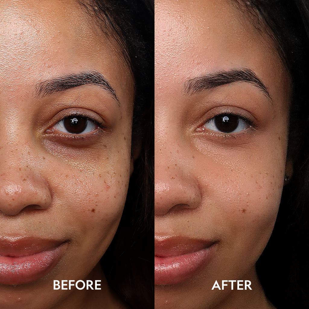 Dark Circle Corrector Serum with Peptides for Bright, Refreshed Under-Eyes
