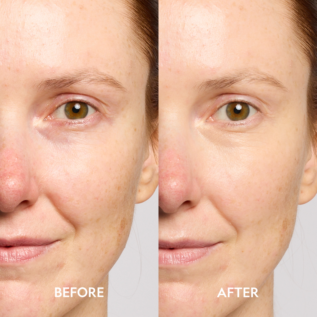 Dark Circle Corrector Serum with Peptides for Bright, Refreshed Under-Eyes