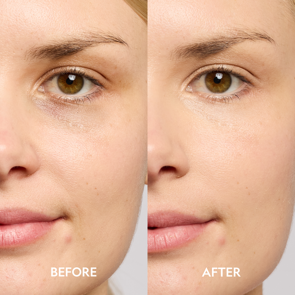 Dark Circle Corrector Serum with Peptides for Bright, Refreshed Under-Eyes