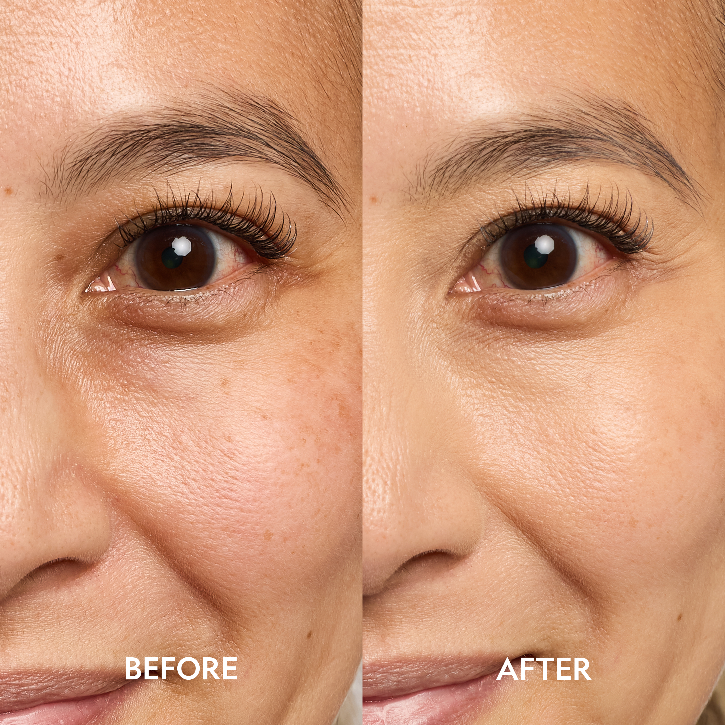 Dark Circle Corrector Serum with Peptides for Bright, Refreshed Under-Eyes